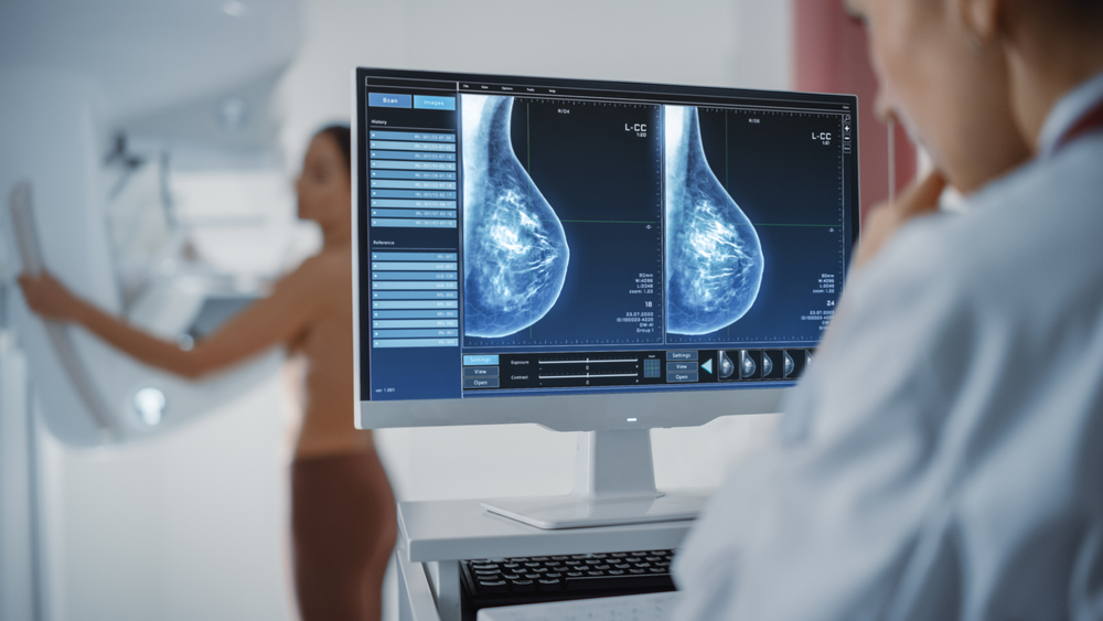 what are dense breasts?