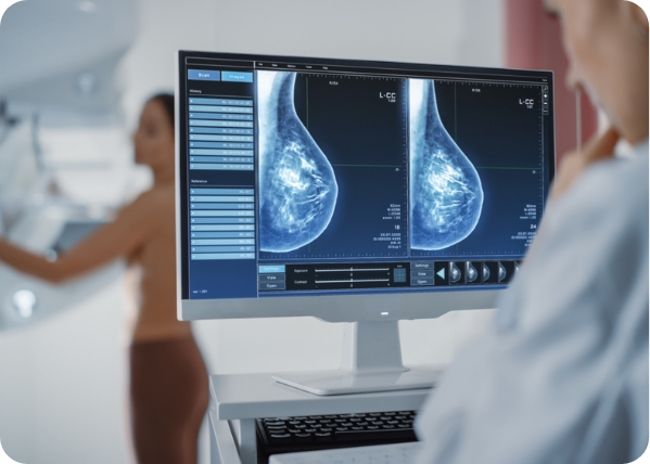 breast_dense_Scan