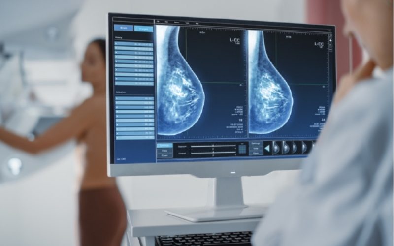 breast_dense_Scan